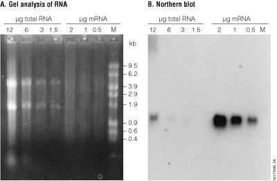 Detection of a α-1-proteinase inhibitor by Northern blot analysis.