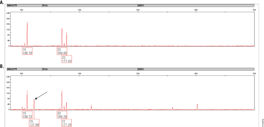 Amplification results of a casework sample with PowerPlex® ESI 17 and ESI 17 Pro Systems
