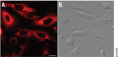 Live-cell imaging of p65-HaloTag protein.